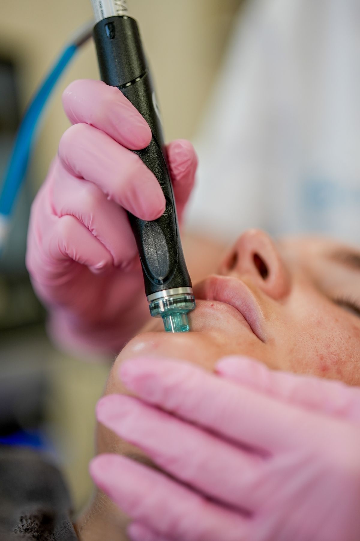 Hydrafacial